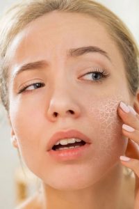 تفاوت پوست خشک و پوست دهیدراته چیست؟