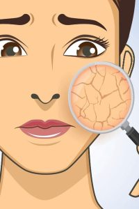تفاوت پوست خشک و دهیدراته چیست؟ راه تشخیص سریع و درمان اصولی